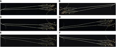 Phenotypic detection of flax plants based on improved Flax-YOLOv5